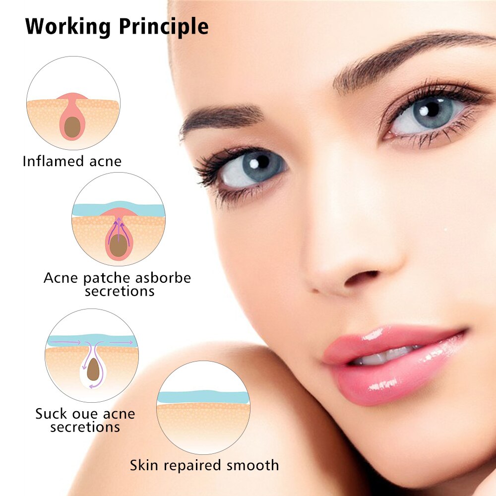 Pimple remover patch for face
