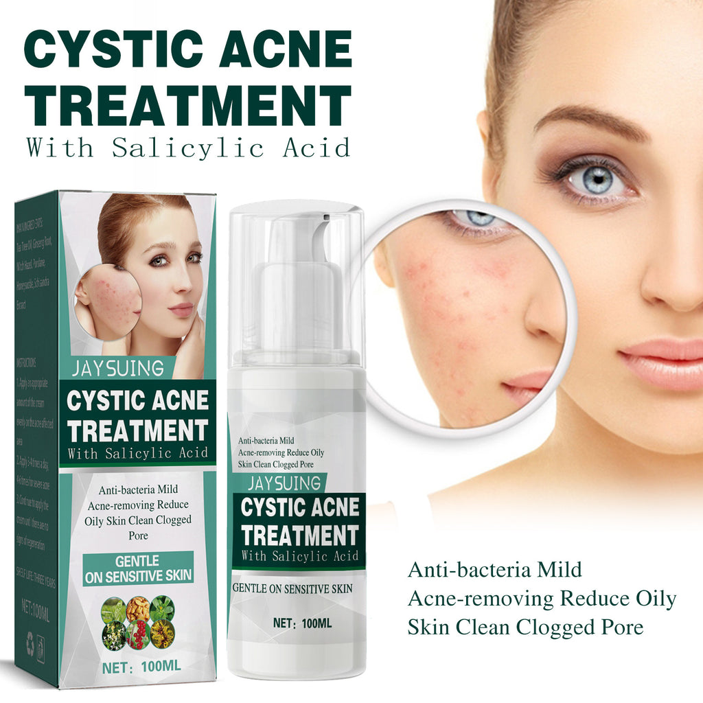Cystic Acne Treatment cream with Salicylic Acid for smoother skin and acne marks reduction.