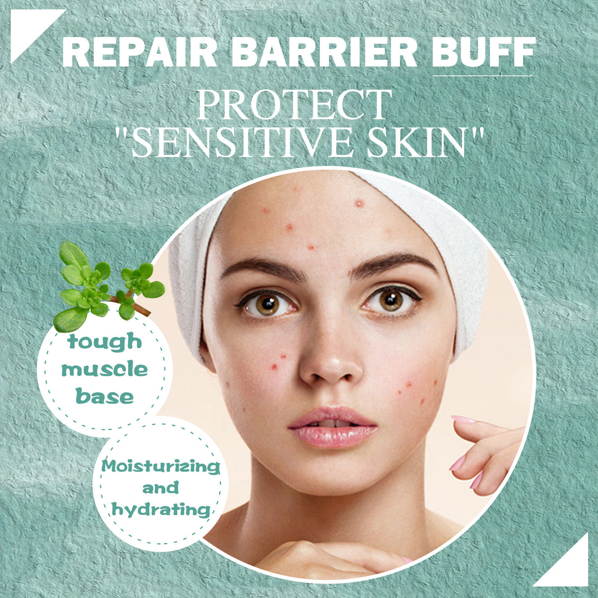 Cystic Acne Treatment cream for sensitive skin, moisturizing and hydrating, designed for tough muscle base and skin protection.