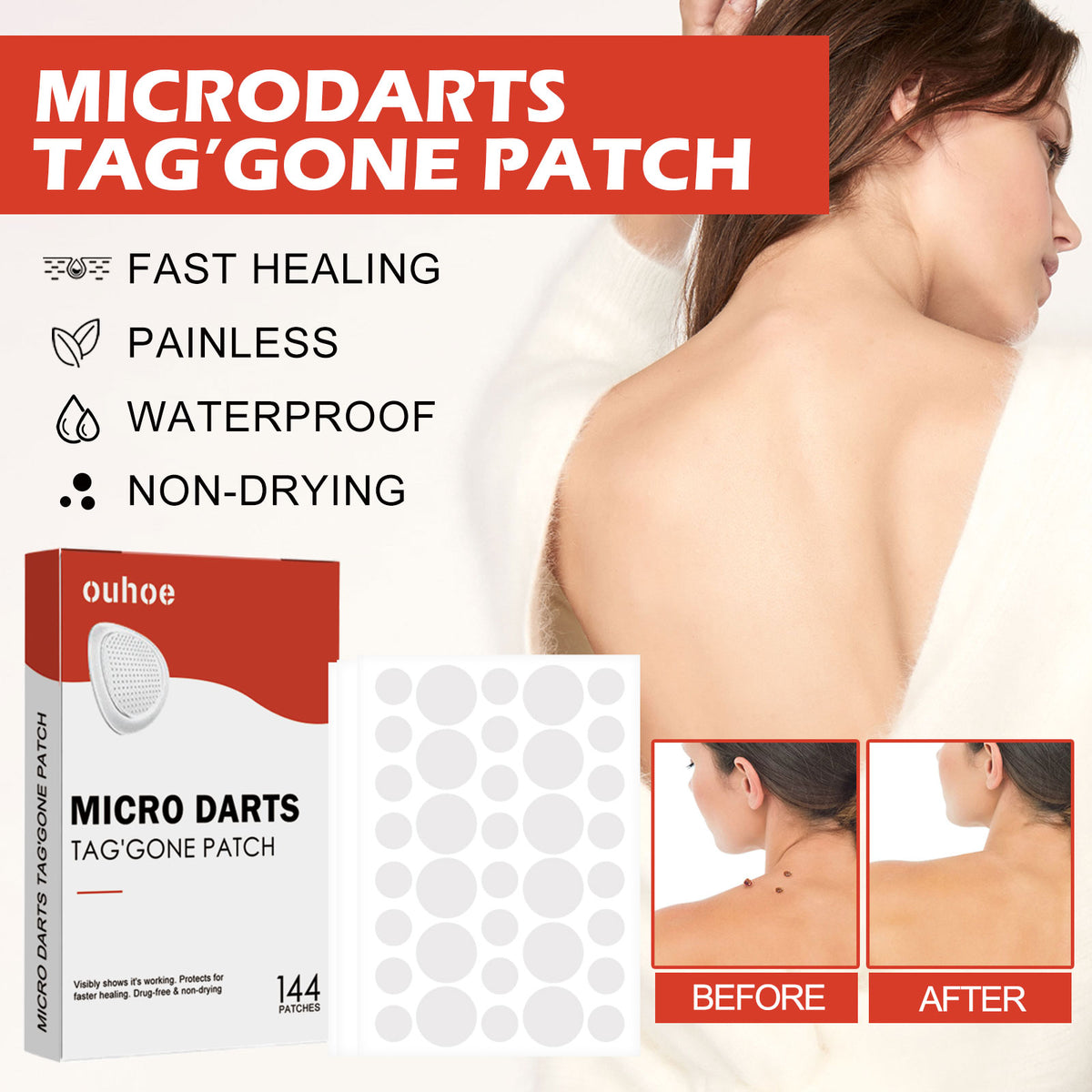 Acne Patch, Skin Clean Acne Pimple Moles Gram Wart Corns Spot Patch