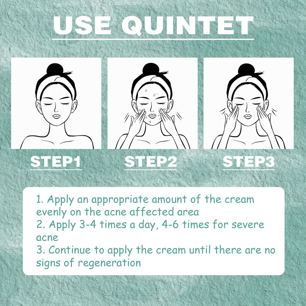 Use Quintet steps for applying Cystic Acne Treatment cream on acne-affected areas for clearer skin.
