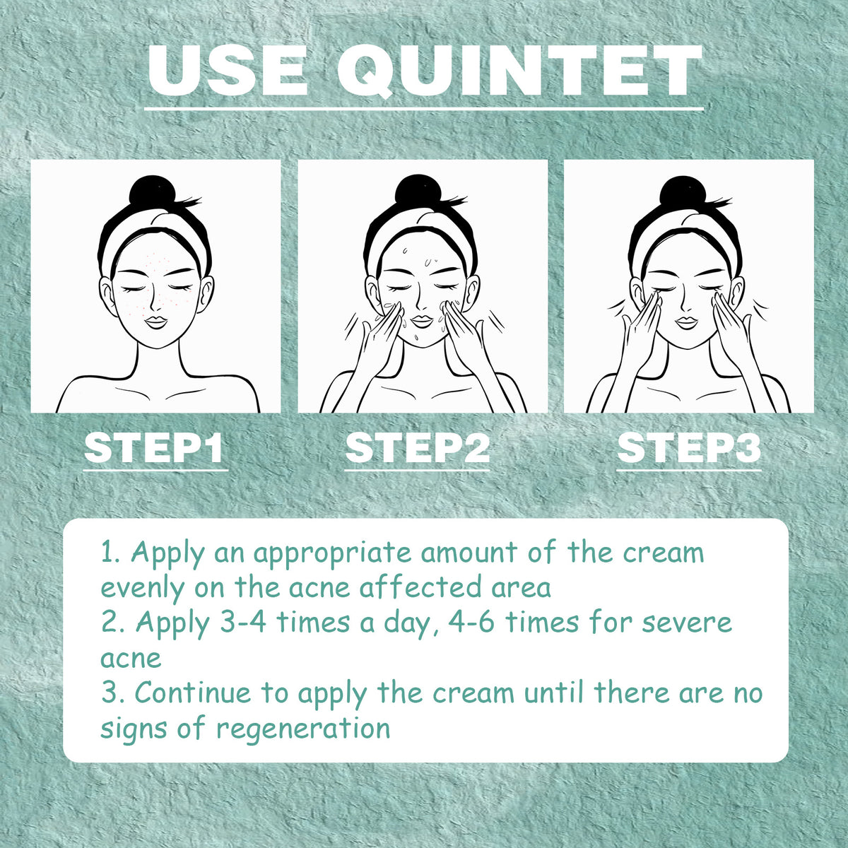 Use Quintet steps for applying Cystic Acne Treatment cream on acne-affected areas for clearer skin.
