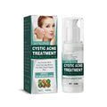 Cystic Acne Treatment cream with Salicylic Acid for smoother skin, designed for closed pimples and acne marks.