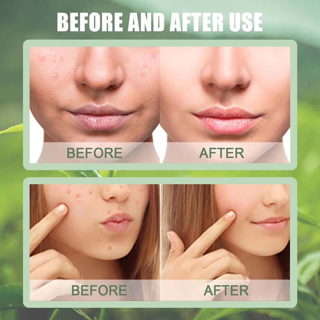Green Tea Mask Stick for Deep Cleansing & Hydration